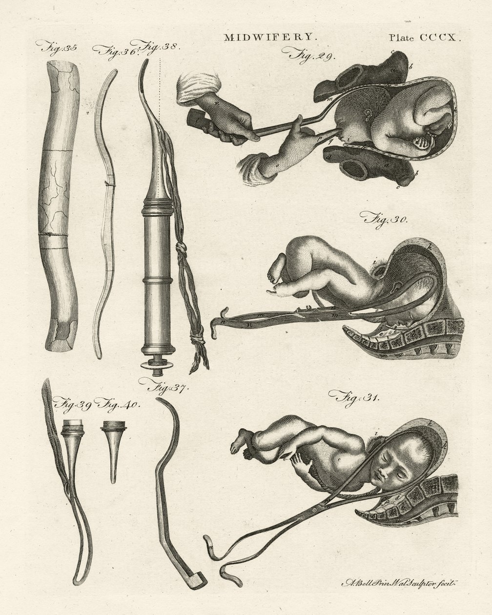 Midwifery (illustration from 