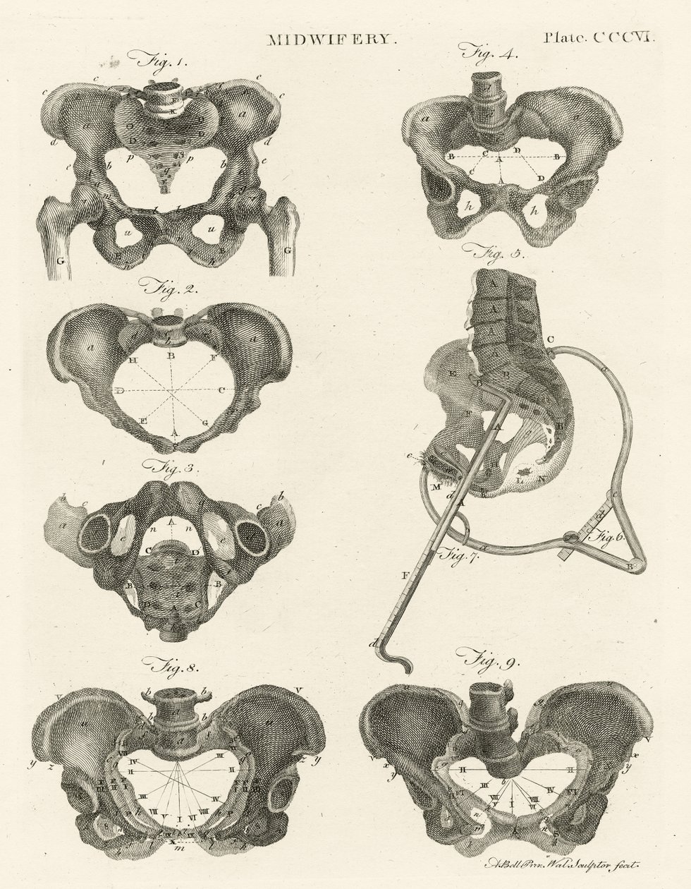 Midwifery, illustration from 
