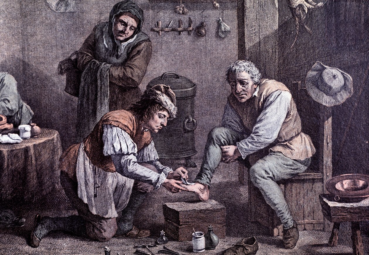 A surgery operation (engraving) by Anonymous Anonymous