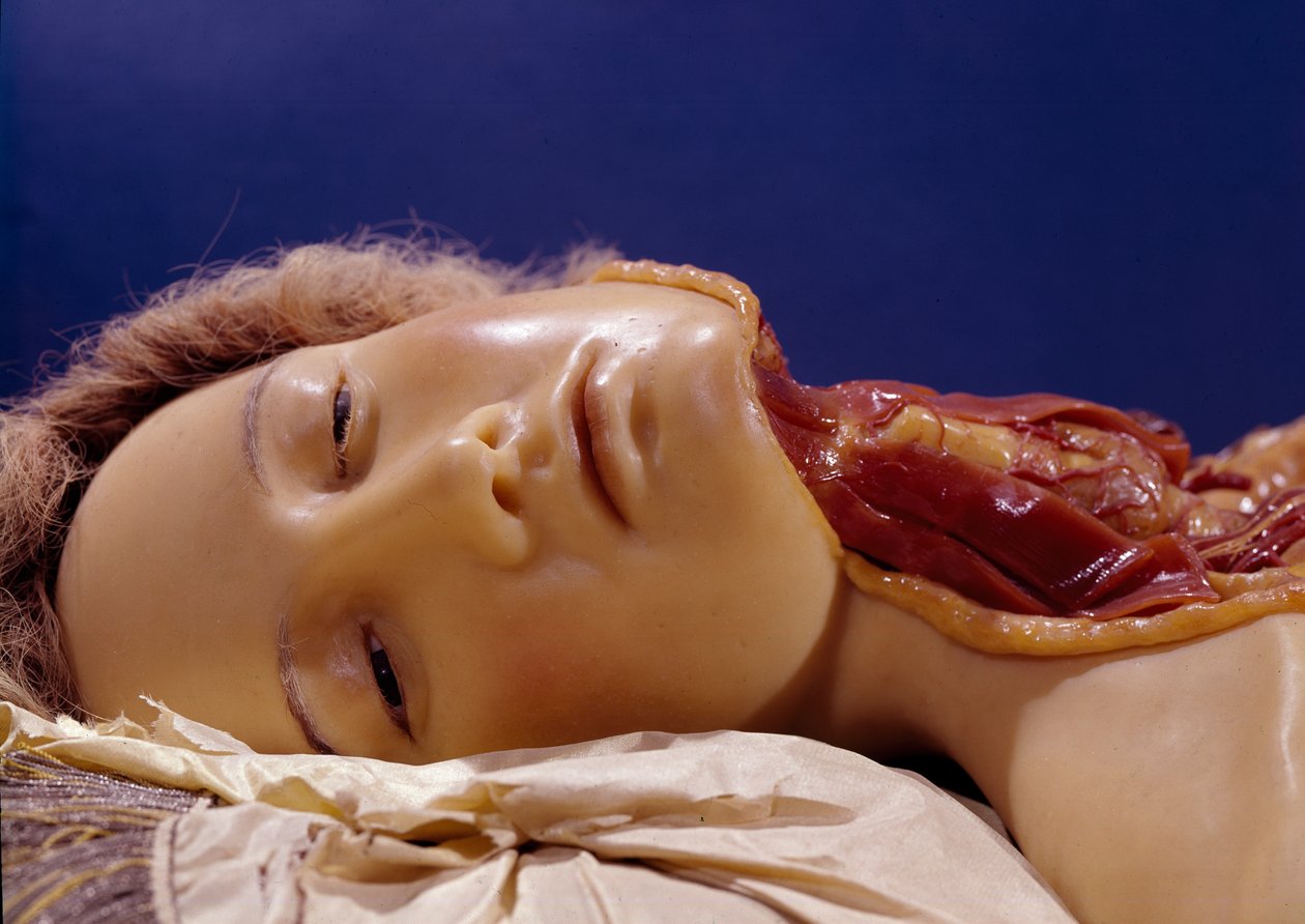Model of a Man Whose Throat Has Been Cut by Clemente Susini