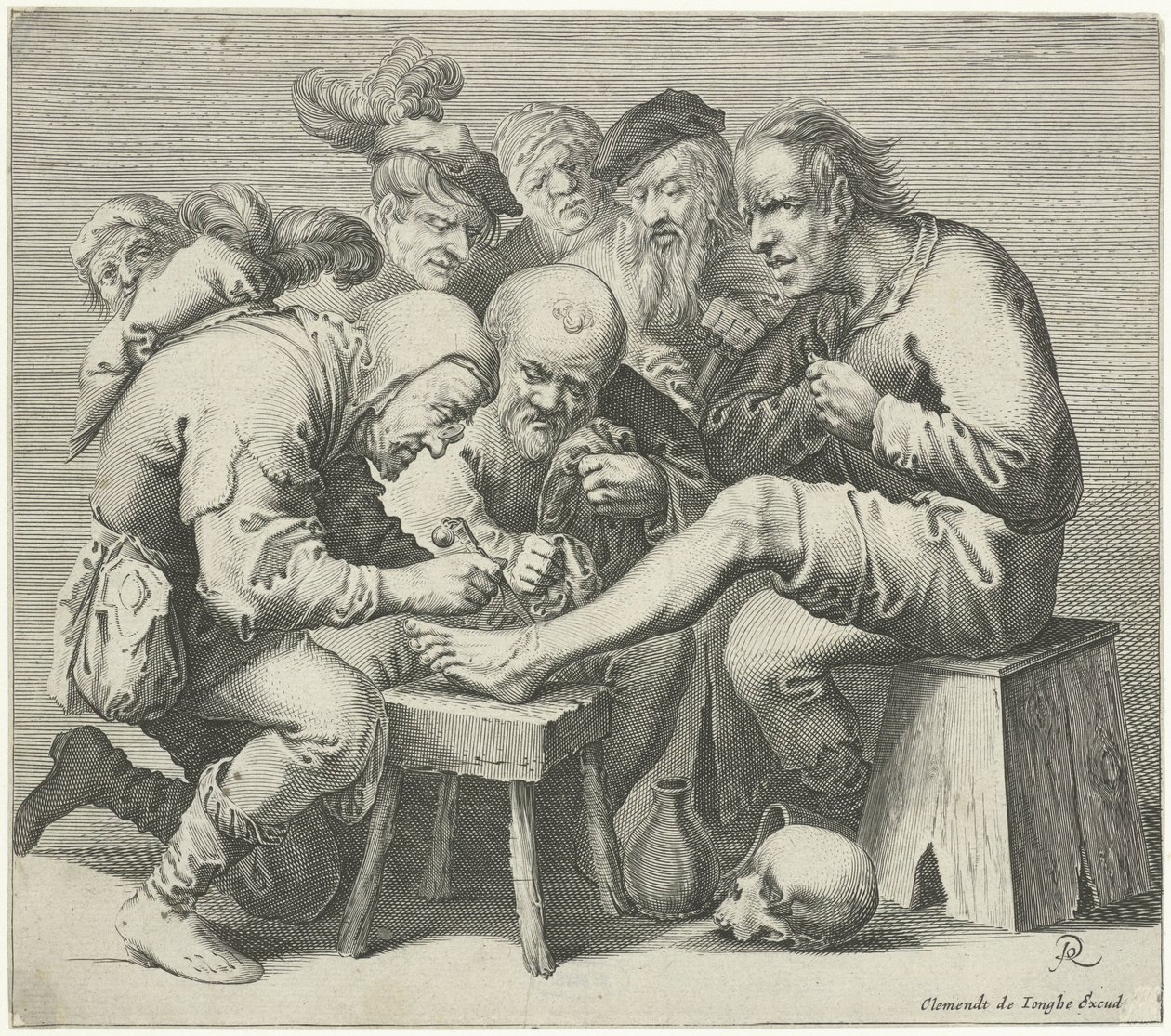 Foot Surgery by Pieter Jansz Quast