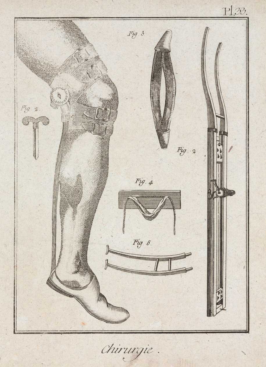 Early-Modern Surgical Supports by Unbekannt