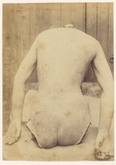 View of the Back of the Trunk by Alphonse Bertillon