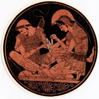 Achilles Bandaging the Wound of Patroclus by Unbekannt