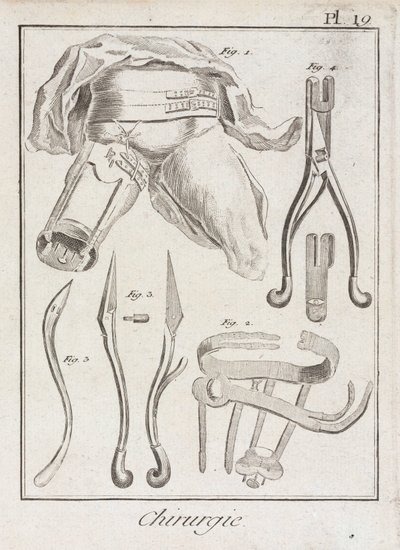 Early-Modern Orthopaedic surgery by Unbekannt
