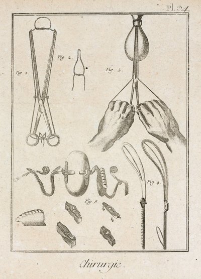 Equipment, Early-Modern Surgical instruments and devices by Unbekannt