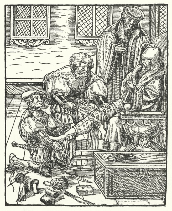 An Amputation by German School